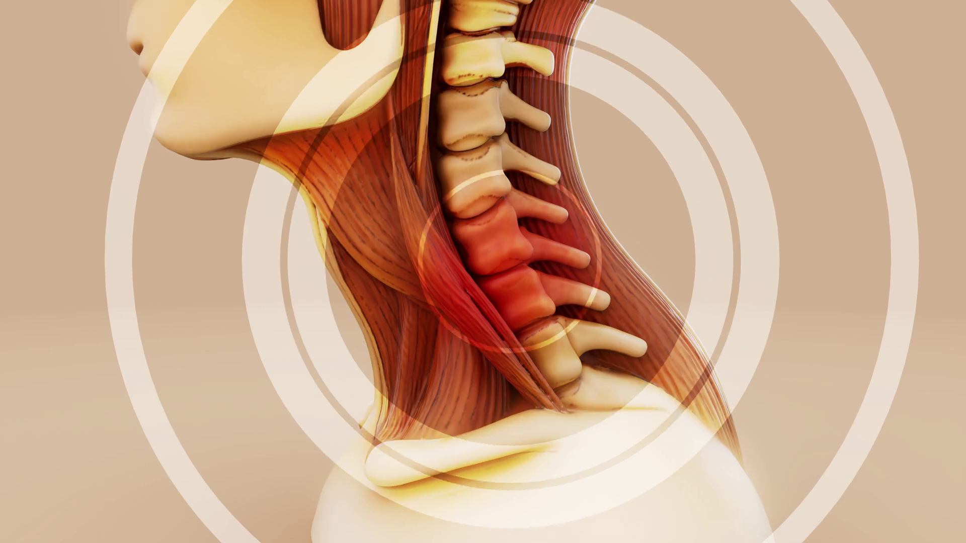 Conceptual 3d Animation Of Neck Strain Stock Footage SBV-352843652 ...