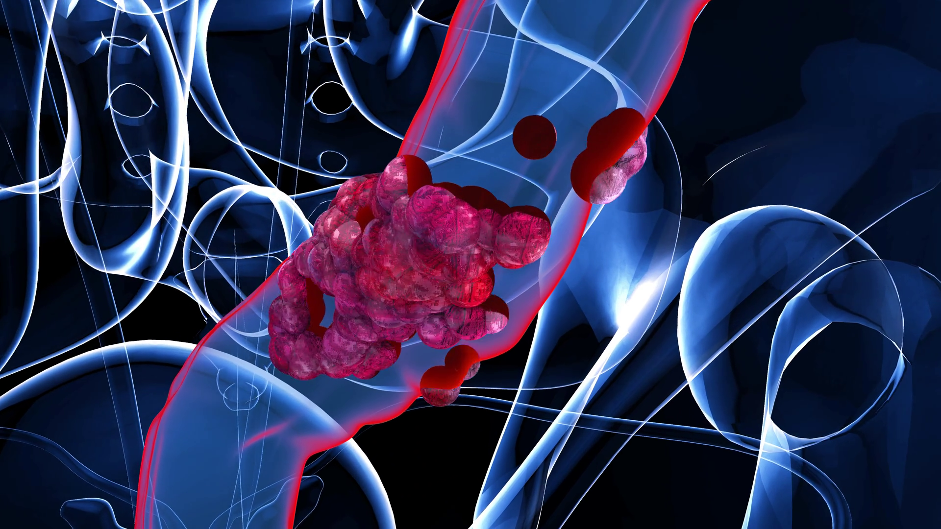 4k Abstract Animation Of Colon Cancer Stock Motion Graphics SBV ...