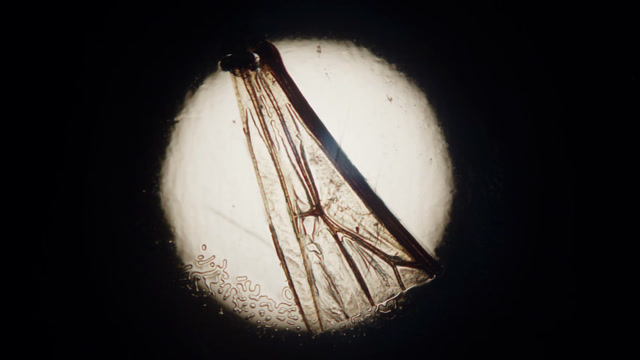 Insects Under A Microscope Stock Footage: Royalty-Free Video Clips ...