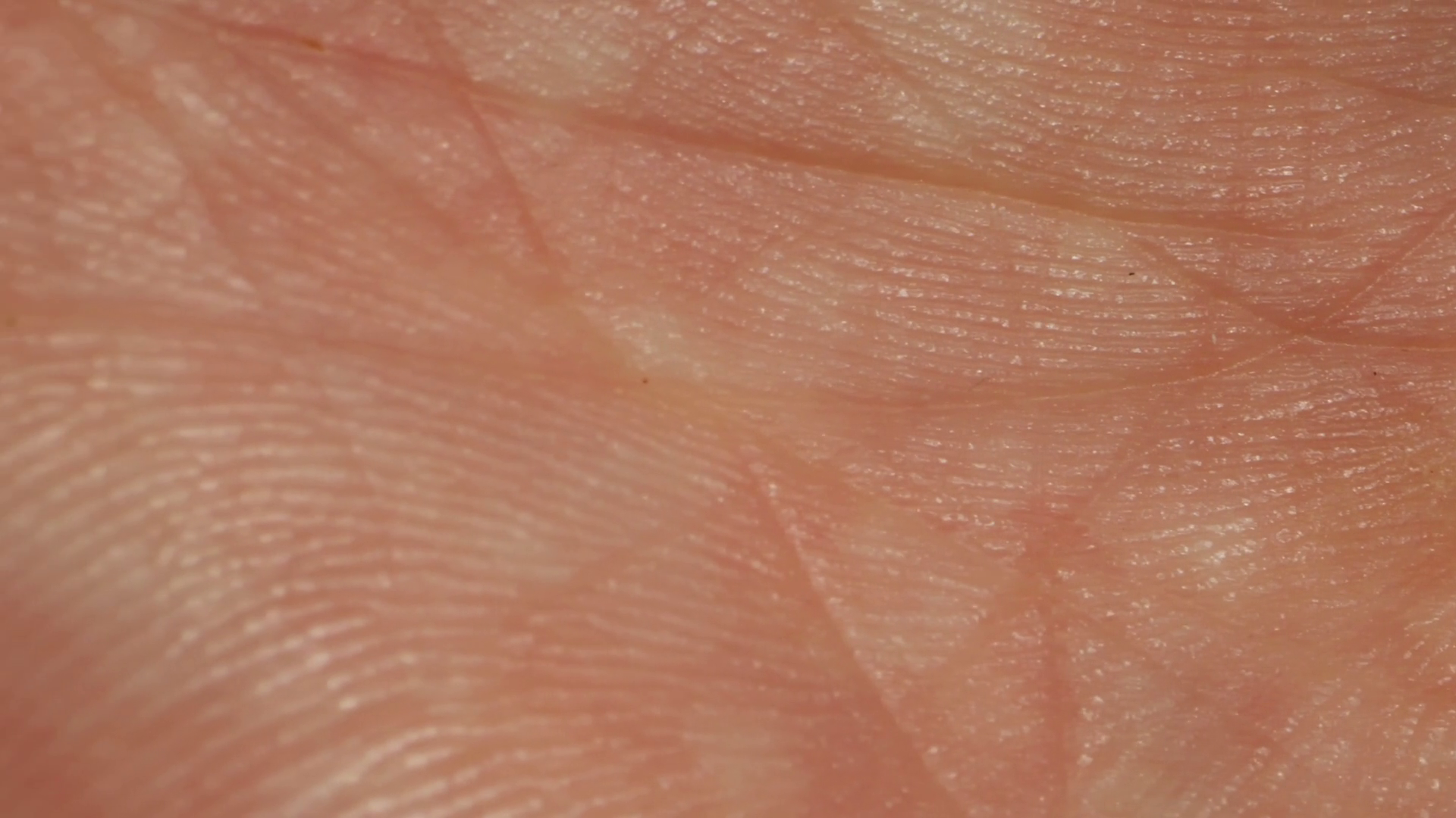 Close-up Of Man Hand Skin Texture Macro Stock Footage SBV-348699954 ...