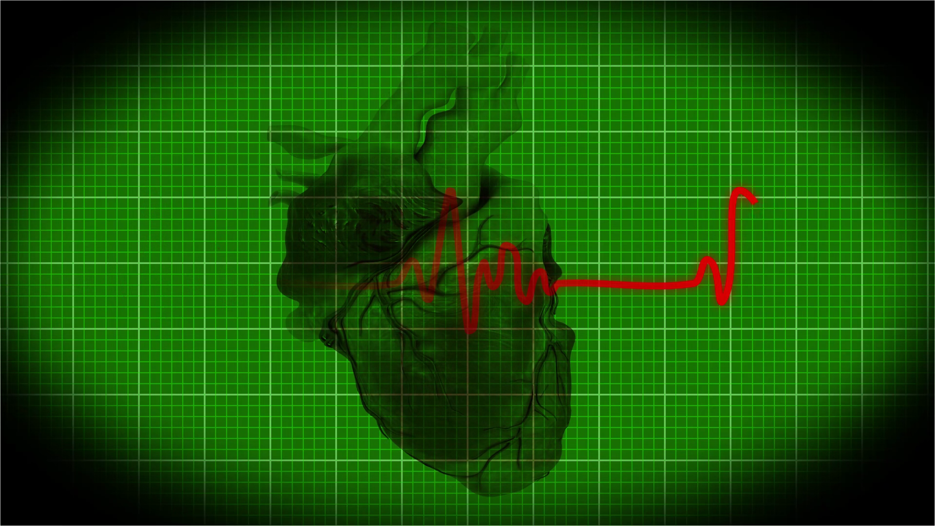 Medical Heart Scan Interface With Human Stock Footage SBV-354728337 ...