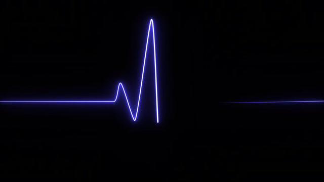 Ekg Animation Stock Footage: Royalty-Free Video Clips - Storyblocks