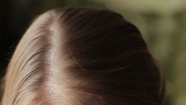 Greasy Hair Stock Footage: Royalty-Free Video Clips - Storyblocks