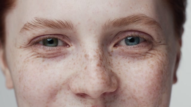 Freckled Face Stock Footage: Royalty-Free Video Clips - Storyblocks