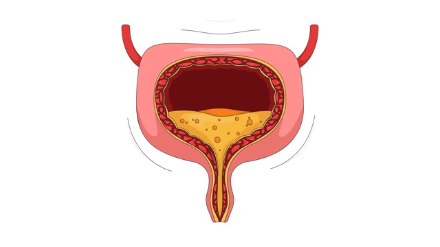 Urinary Incontinence Stock Footage: Royalty-Free Video Clips - Storyblocks
