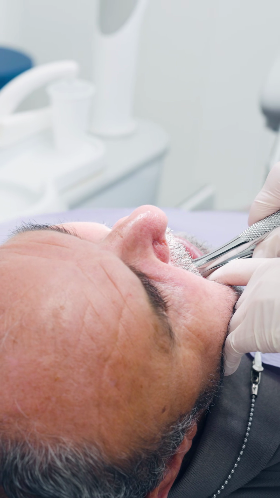 Dental Surgeon Performing Tooth Extraction Stock Footage SBV-353990947 ...