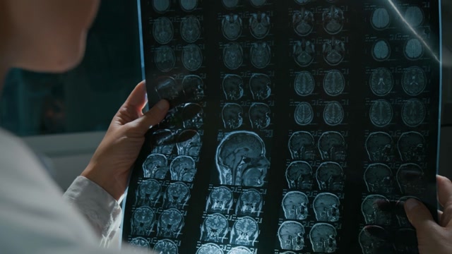 Brain Mri Stock Footage: Royalty-Free Video Clips - Storyblocks