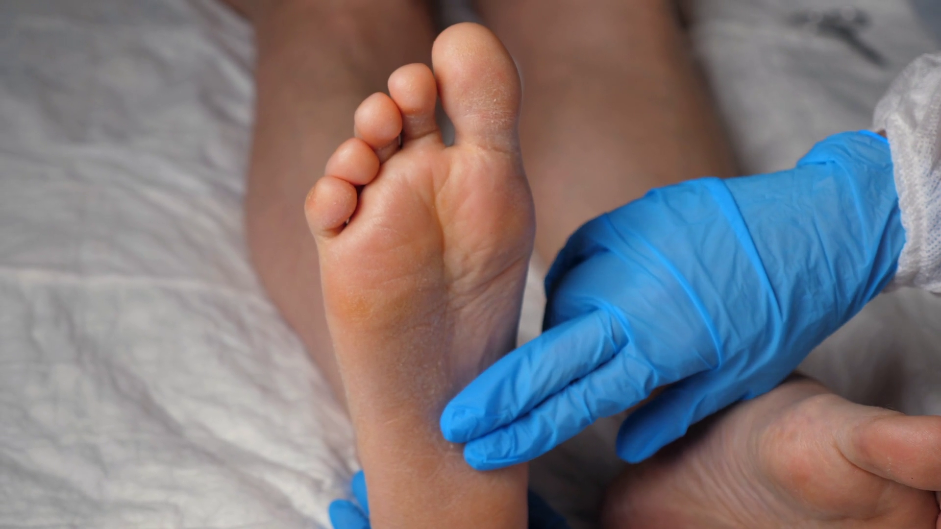 A Nurse Examines Patient's Leg During Stock Footage SBV-348749611 ...