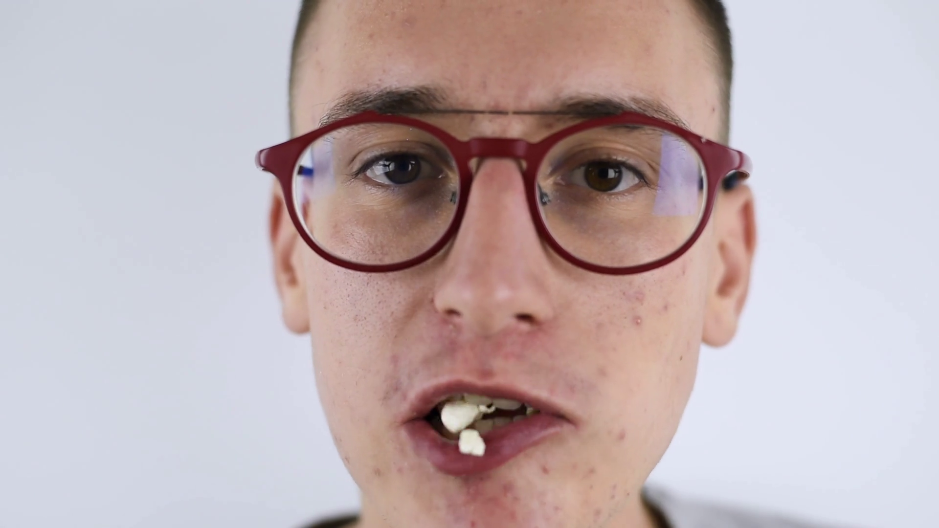 Young Pimply Man In Red Glasses Eating Stock Footage SBV-352502359 ...
