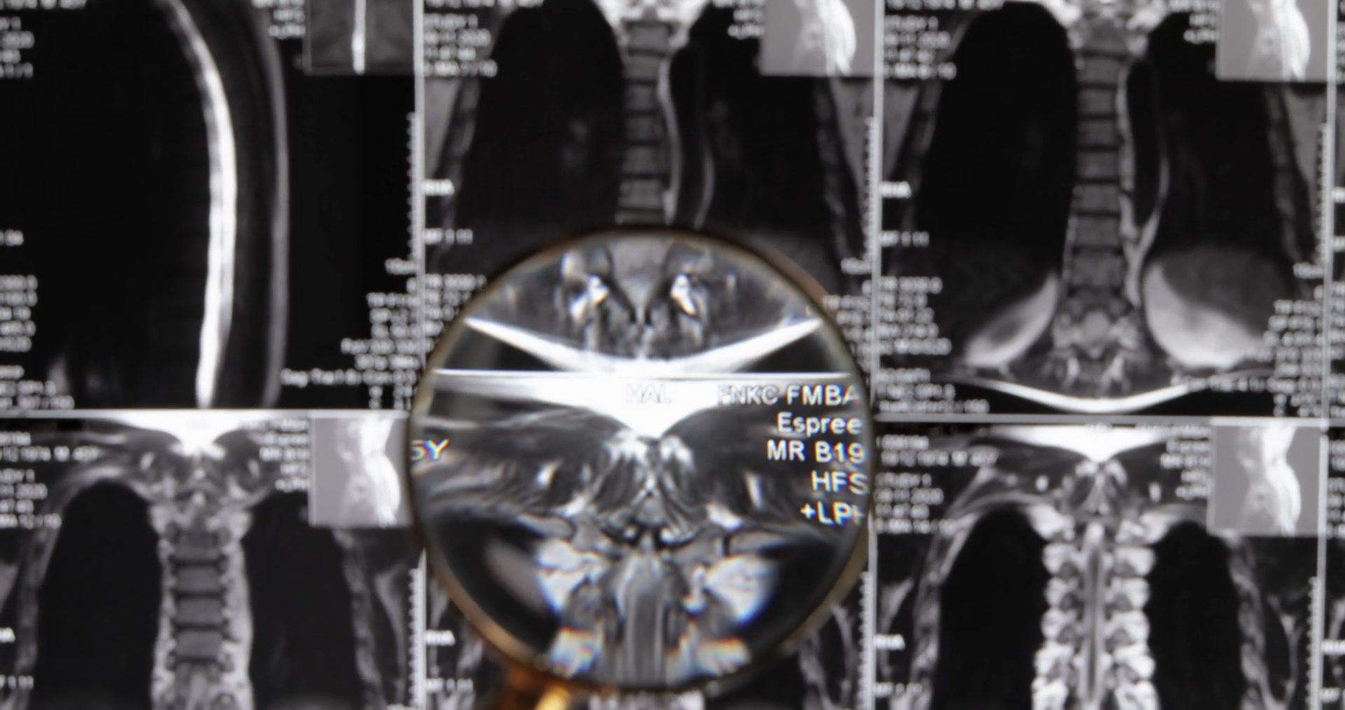 Mri Lumbar Spine Background Magnetic Stock Footage SBV-338955263 ...