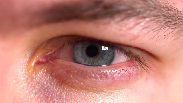 Shortsighted Stock Footage: Royalty-Free Video Clips - Storyblocks