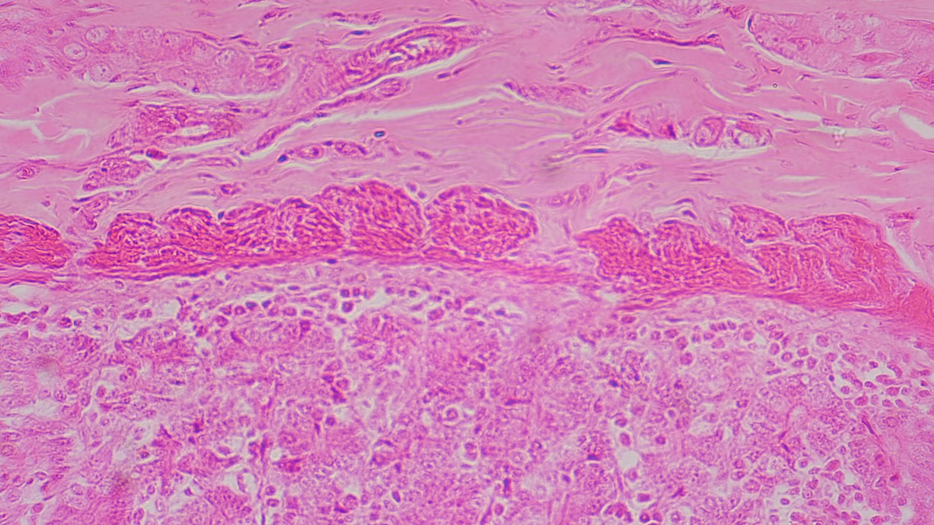 Microscopic Tissue Section Small Intestine Stock Footage SBV-354431634 ...