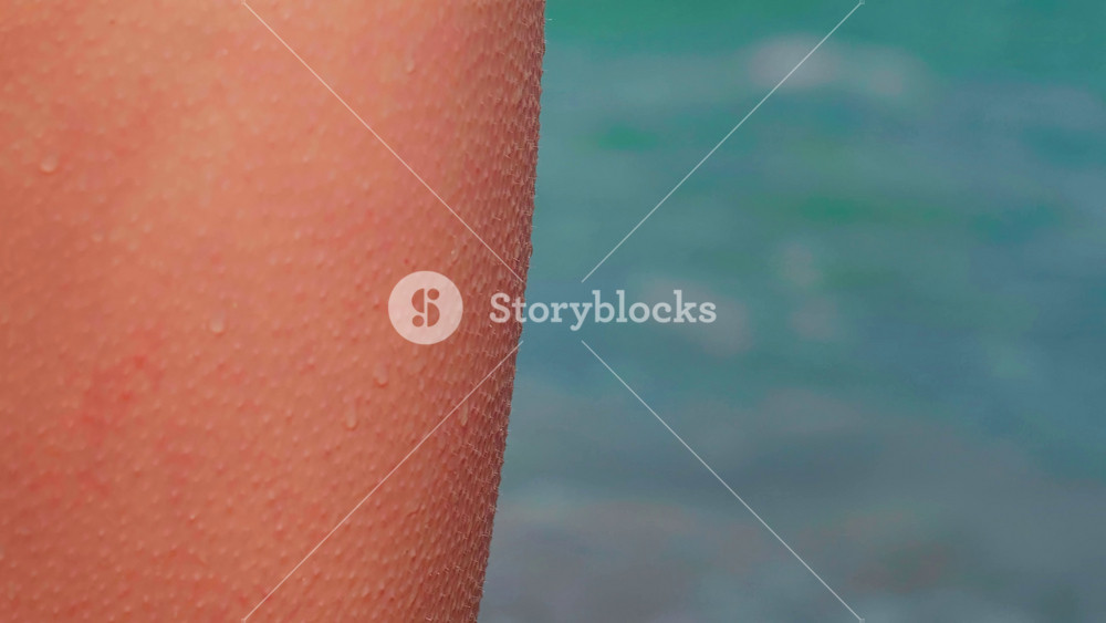 Caucasian woman having chills on skin on cold and windy summer day. Goosebumps on on a woman thighs on freezing day at seashore. Close up skin.
