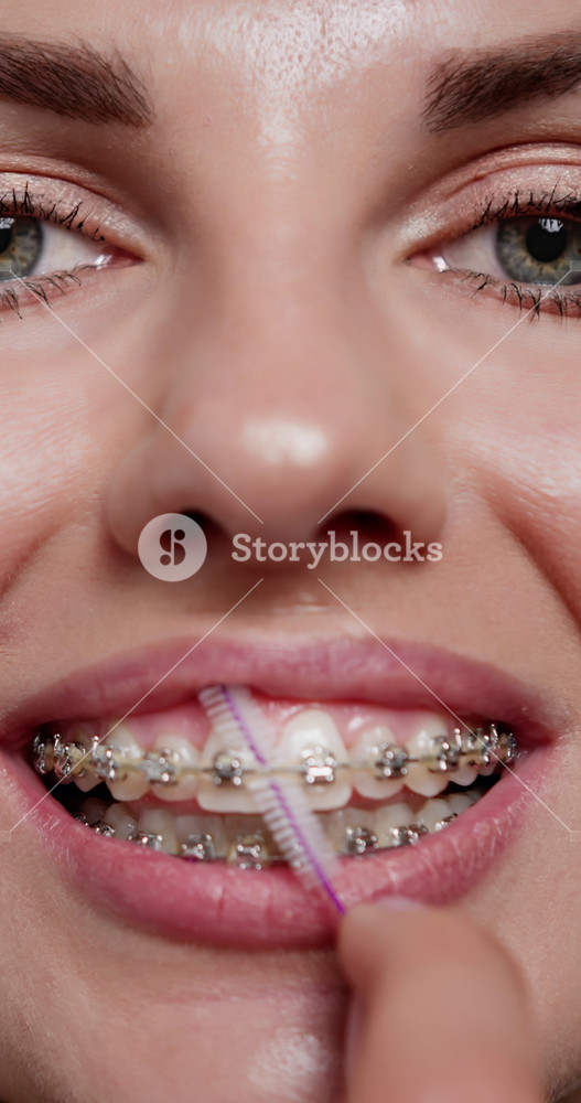 Vertical video. Close-up of young woman at home brushing braces with orthodontic toothbrush. Focus on oral hygiene and health care. Concept