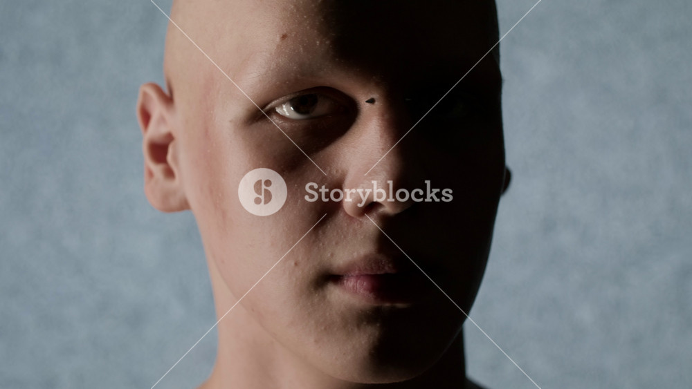 Striking close-up portrait of person with alopecia, with dramatic half-lighting highlighting his facial features, turning at camera with serious gaze, set against textured gray background