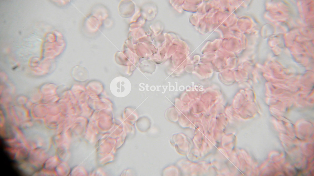 Microscope Perspective Error Fresh blood seen on a 1000x microscope view. Blood smear under ...